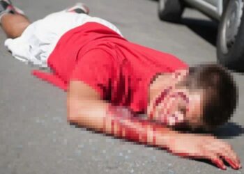 Foreign National Sustains Serious Injuries in Fight with Others